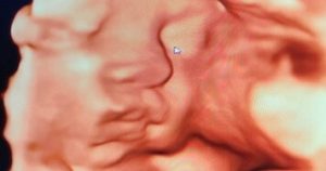 3D-4D ultrazvučni pregled - Biovita