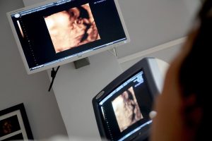 Ekspertni ultrazvučni pregled