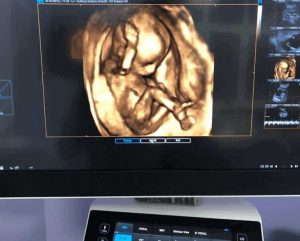 Ekspertni ultrazvučni pregled(2)
